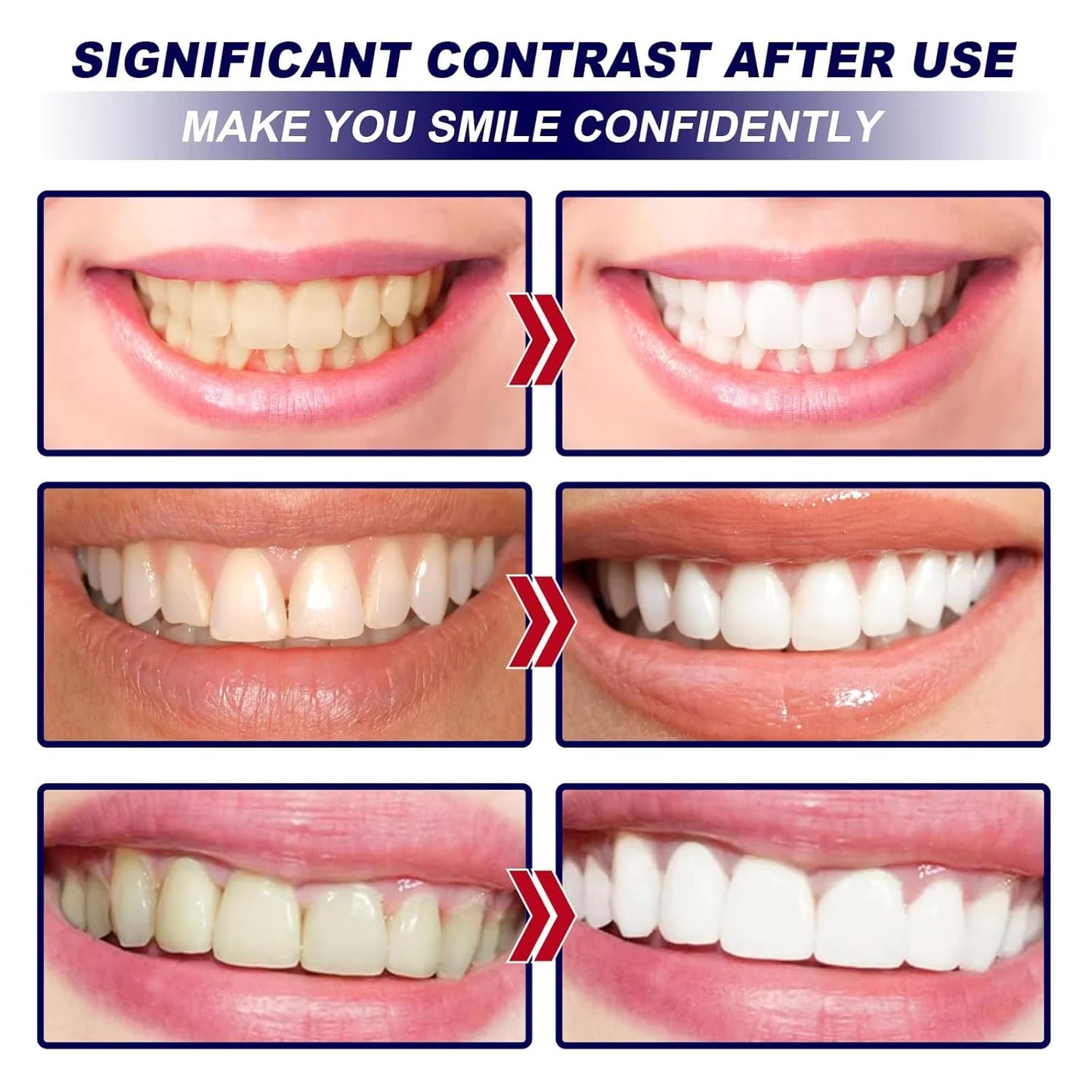 Teeth Whitening Strips